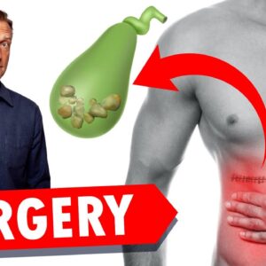 Gallbladder Surgery (Removal): WATCH THIS!